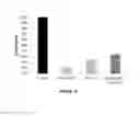 Fig. 15 - Baclofen and acamprosate based therapy of neurological disorders