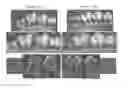 Fig. 01 - Methods for increasing oral osteogenesis using lipoxin A4 (LXA4) and its analogs