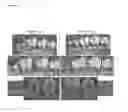 Fig. 04 - Methods for increasing oral osteogenesis using lipoxin A4 (LXA4) and its analogs