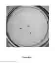 Fig. 11 - Method of Inhibiting or Treating a Dengue Virus Infection with Quercetin