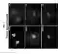 Fig. 02 - PAR1 MODULATION TO ALTER MYELINATION