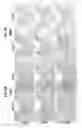 Fig. 09 - PAR1 MODULATION TO ALTER MYELINATION