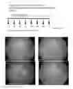 Fig. 02 - Method for treating eye diseases