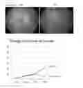 Fig. 07 - Method for treating eye diseases