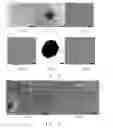 Fig. 06 - Use of allogeneic interstitial vessel-layer cell and allogeneic mesenchymal progenitor cell for preventing or treating osteoarthritis
