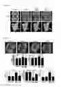 Fig. 10 - A COMPOSITION FOR IMPROVING JOINT HEALTH, OR FOR PREVENTING AND TREATING RHEUMATOID ARTHRITIS AND OSTEOARTHRITIS