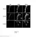 Fig. 07 - Use of PEDF-derived polypeptides for promoting muscle or tendon regeneration or arteriogenesis