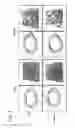 Fig. 04 - CTHRC1 RECEPTOR AND METHODS OF USE THEREOF