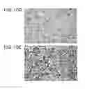 Fig. 22 - CTHRC1 RECEPTOR AND METHODS OF USE THEREOF