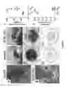 Fig. 02 - Conditional angiopoietin-1/angiopoietin-2 double knock-out mice with defective ocular drainage system