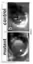 Fig. 03 - Conditional angiopoietin-1/angiopoietin-2 double knock-out mice with defective ocular drainage system