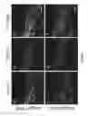 Fig. 08 - Conditional angiopoietin-1/angiopoietin-2 double knock-out mice with defective ocular drainage system