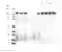 Fig. 76 - COMPOSITIONS AND METHODS FOR TREATING COLLAGEN-MEDIATED DISEASES