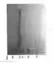Fig. 85 - COMPOSITIONS AND METHODS FOR TREATING COLLAGEN-MEDIATED DISEASES