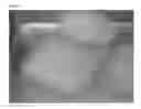Fig. 02 - Methods for producing a biodegradable chitosan composition and uses thereof