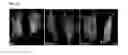 Fig. 13 - Methods and compositions for targeting adipose cells in mammals