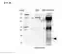 Fig. 15 - Methods and compositions for targeting adipose cells in mammals