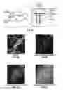 Fig. 04 - Methods for evaluating brain-wide paravascular pathway for waste clearance function and methods for treating neurodegenerative disorders based thereon