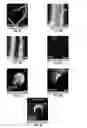 Fig. 05 - Methods for evaluating brain-wide paravascular pathway for waste clearance function and methods for treating neurodegenerative disorders based thereon