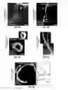 Fig. 06 - Methods for evaluating brain-wide paravascular pathway for waste clearance function and methods for treating neurodegenerative disorders based thereon