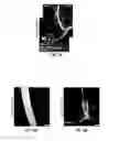 Fig. 19 - Methods for evaluating brain-wide paravascular pathway for waste clearance function and methods for treating neurodegenerative disorders based thereon