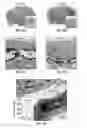 Fig. 22 - Methods for evaluating brain-wide paravascular pathway for waste clearance function and methods for treating neurodegenerative disorders based thereon