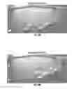 Fig. 33 - Methods for evaluating brain-wide paravascular pathway for waste clearance function and methods for treating neurodegenerative disorders based thereon