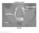 Fig. 34 - Methods for evaluating brain-wide paravascular pathway for waste clearance function and methods for treating neurodegenerative disorders based thereon