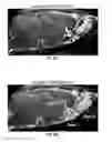 Fig. 45 - Methods for evaluating brain-wide paravascular pathway for waste clearance function and methods for treating neurodegenerative disorders based thereon