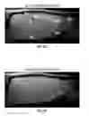 Fig. 46 - Methods for evaluating brain-wide paravascular pathway for waste clearance function and methods for treating neurodegenerative disorders based thereon