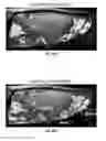 Fig. 47 - Methods for evaluating brain-wide paravascular pathway for waste clearance function and methods for treating neurodegenerative disorders based thereon