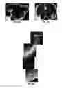 Fig. 50 - Methods for evaluating brain-wide paravascular pathway for waste clearance function and methods for treating neurodegenerative disorders based thereon