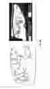 Fig. 52 - Methods for evaluating brain-wide paravascular pathway for waste clearance function and methods for treating neurodegenerative disorders based thereon