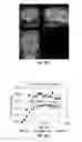 Fig. 66 - Methods for evaluating brain-wide paravascular pathway for waste clearance function and methods for treating neurodegenerative disorders based thereon