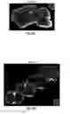 Fig. 74 - Methods for evaluating brain-wide paravascular pathway for waste clearance function and methods for treating neurodegenerative disorders based thereon