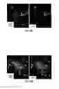 Fig. 82 - Methods for evaluating brain-wide paravascular pathway for waste clearance function and methods for treating neurodegenerative disorders based thereon