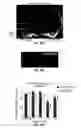 Fig. 93 - Methods for evaluating brain-wide paravascular pathway for waste clearance function and methods for treating neurodegenerative disorders based thereon