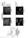 Fig. 95 - Methods for evaluating brain-wide paravascular pathway for waste clearance function and methods for treating neurodegenerative disorders based thereon