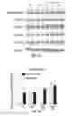 Fig. 98 - Methods for evaluating brain-wide paravascular pathway for waste clearance function and methods for treating neurodegenerative disorders based thereon