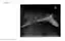 Fig. 09 - Biodegradable implant and method for manufacturing same