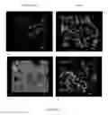 Fig. 06 - Composite Matrix for Bone Repair Applications