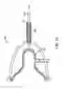 Fig. 10 - METHODS AND APPARATUS FOR ABATING NOISE DURING EXPRESSION OF HUMAN BREAST MILK