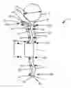 Fig. 01 - Dialysis implant and methods of use