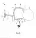 Fig. 06 - Dialysis implant and methods of use