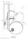 Fig. 19 - Dialysis implant and methods of use