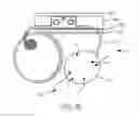 Fig. 23 - Dialysis implant and methods of use