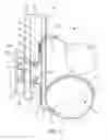 Fig. 26 - Dialysis implant and methods of use