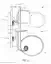 Fig. 28 - Dialysis implant and methods of use