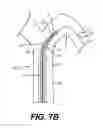 Fig. 11 - Dilator systems and methods