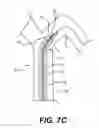 Fig. 12 - Dilator systems and methods